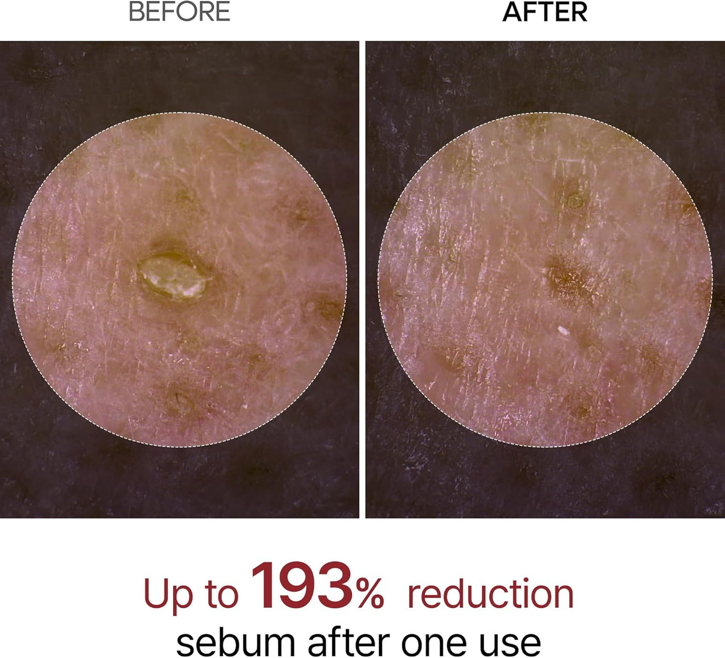 Dr. Melaxin Black Rice Peel Shot Glow – Exfoliating Ampoule 80ml