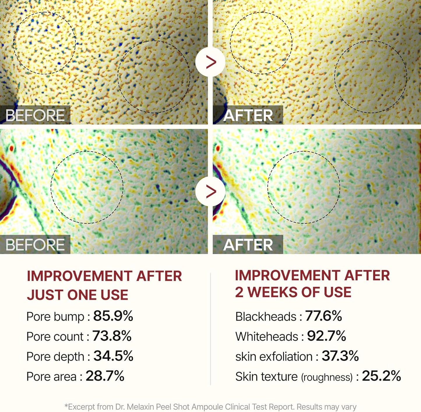 Dr. Melaxin Rice Peel Shot Glow – Exfoliating Ampoule 80ml | Korean Skincare